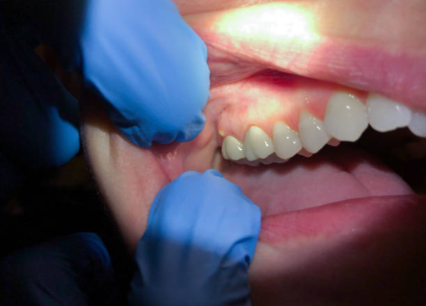 Best Emergency Root Canal Therapy in Lliams Bay, WI